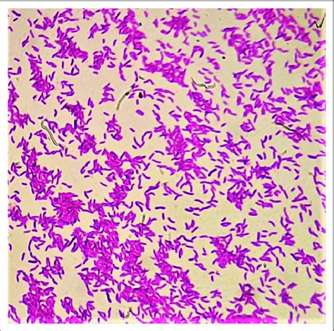 vibrio cholerae gram stain